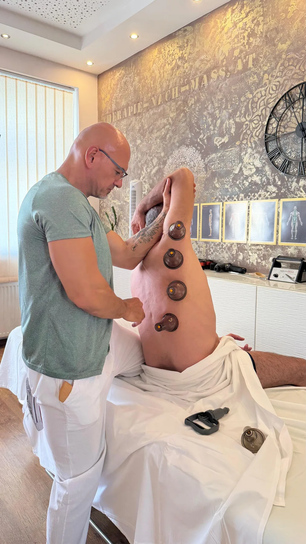 Schröpfgläser auf dem Rücken eines Patienten